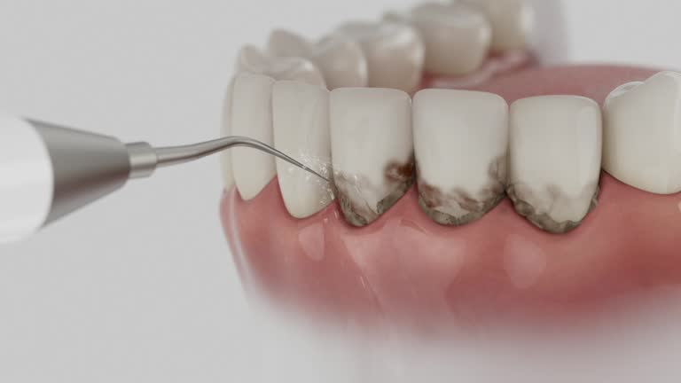 Reliable Dental contractor in Lakesite, TN by Smile Center Dentistry